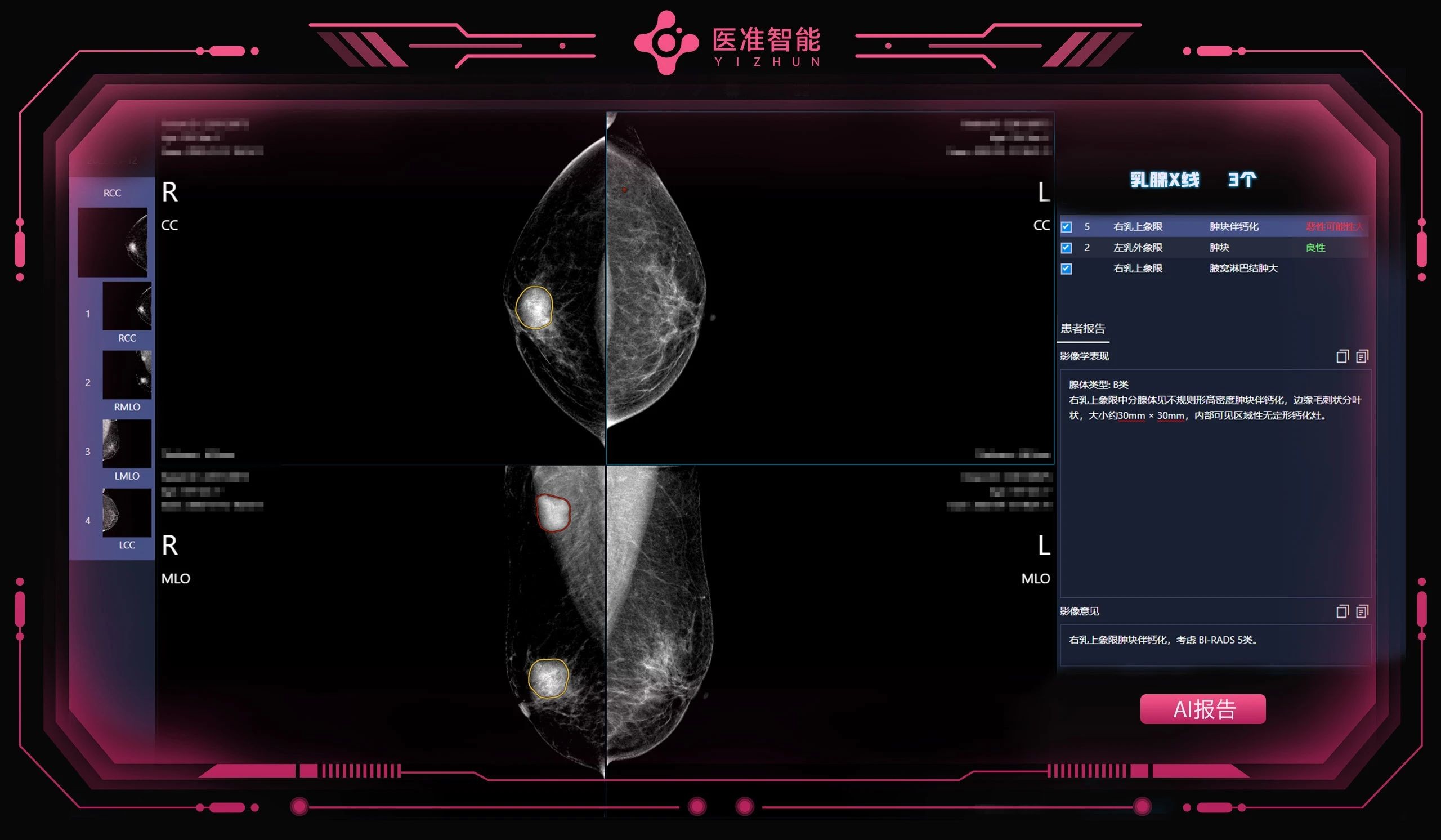 医准智能斩获首张乳腺超声AI三类证，万孚生物产业基金入股